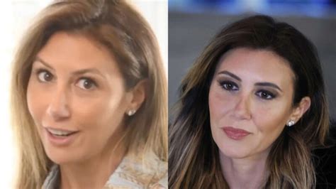 alina habba plastic surgery|alina habba botox.